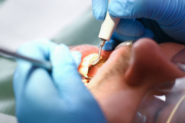 Best Knocked-Out Tooth Emergency  in Elgin, OK