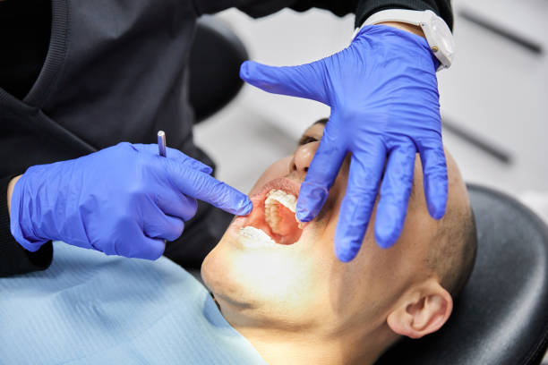 Best Dentist for Tooth Abscess  in Elgin, OK